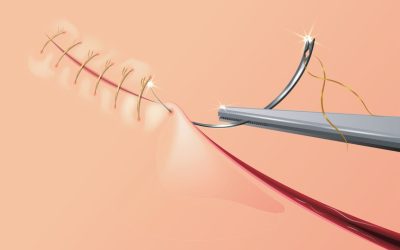 A Stitch of a Kind: Artful Suturing
